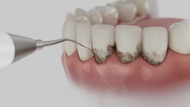 Trusted Tooth Extraction service in East Uniontown, PA - Dentist Open Now